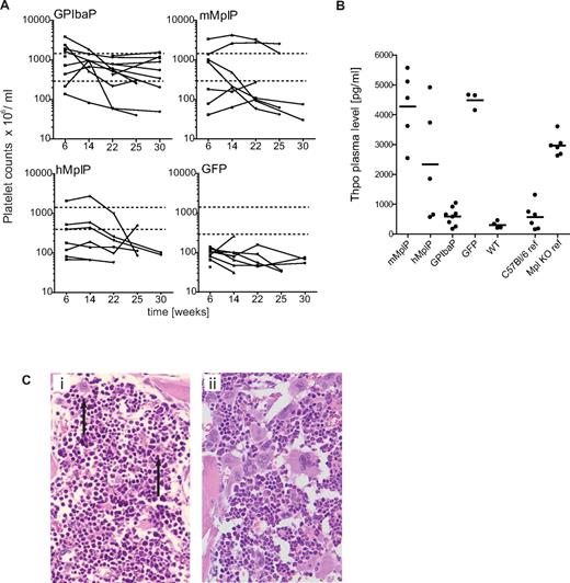 Figure 4. Rescue of thrombocytopenia in Mpl−/− mice after Mpl gene therapy. Mpl−/− mice were transplanted with Lin− Mpl−/− BM cells transduced with SIN lentiviral vectors expressing Mpl from lineage-specific promoters as indicated, or eGFP from the PGK promoter (GFP). Lin− BM from C57Bl/6J was transplanted as positive control (wt). (A) Peripheral blood thrombocyte counts of transplanted Mpl−/− mice were monitored every 6 weeks in 3 independent experiments up to 25 or 31 weeks, respectively. Hatched lines represent the window of therapeutic success (> 2-fold more than mean eGFP platelet counts and lower as 1500 × 106/mL). (B) Thrombopoietin plasma levels as determined by ELISA from plasma taken on final analysis (25 or 31 weeks). Untreated Mpl−/− mice (Mpl−/− ref) show 5- to 6-fold increased Thpo levels compared with untreated C57Bl/6 (C57Bl/6 ref) mice (GPIbaP vs GFP, P < .0001; hMplP vs GFP, P = .11; GPIbaP vs WT, P = .11; WT vs GFP, P < .0001; mean ± SEM; Student t test, 2-tailed, unpaired). (C) Representative histologic analysis of the BM from a control Mpl−/− mouse, which expressed eGFP by the PGK promoter (i) and a mouse that expressed Mpl by the GPIba promoter (ii). Advanced megakaryocyte maturation was found in treated mice compared with micro-megakaryocytes (arrows) in GFP control animals. Hematoxylin and eosin staining; original magnification, ×200.