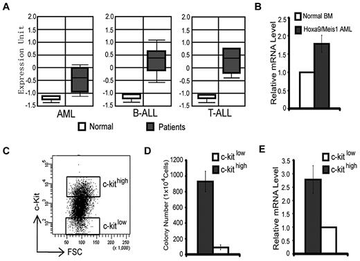 Figure 1. Expression of Kdm2b/Jhdm1b is up-regulated in leukemic stem cells. (A) KDM2B/JHDM1B is overexpressed at the RNA level in human AML, T-cell acute lymphoid leukemia (T-ALL), and B-cell acute lymphoid leukemia (B-ALL) compared with their normal controls. Data are derived from Oncomine. 22 (B) Kdm2b/Jhdm1b is overexpressed in Hoxa9/Meis1-induced AML samples compared with that of normal BM. Relative mRNA levels are measured by RT-qPCR and normalized to Gapdh level. The level in normal BM is arbitrarily set to 1. (C) Separation of Hoxa9/Meis1-transformed murine AML cells into c-kithigh and c-kitlow populations by FACS. These 2 cell populations are used for methylcellulose colony formation assays. (D) The c-kithigh cell population has higher colony formation capability compared with the c-kitlow population. (E) RT-qPCR analysis shows that the c-kithigh cell population expresses a higher level of Kdm2b/Jhdm1b than the c-kitlow cell population. Relative mRNA levels are measured by RT-qPCR and normalized to Gapdh level. The level of c-kitlow population is arbitrarily set to 1. FSC indicates forward scatter.