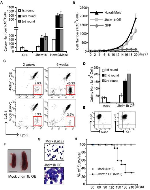 Figure 2. Enforced expression of Kdm2b/Jhdm1b is sufficient for BM transformation. (A) Enforced expression of Kdm2b/Jhdm1b is capable of immortalizing BM cells in vitro. Shown are colony numbers of c-kit+ HPCs transduced with lentiviral vectors expressing GFP, Kdm2b/Jhdm1b, or Hoxa9-Meis1 at each round of methylcellulose replating. (B) Growth curve of c-kit+ hematopoietic progenitors transduced with lentiviral vectors expressing GFP, Kdm2b/Jhdm1b, or Hoxa9-Meis1 in suspension culture. (C) FACS analysis of the genetically modified Ly5.2+ donor cells, LacZ and Jhdm1b overexpression (Jhdm1b OE) in the peripheral blood of recipients. The results show that the percentage of Kdm2b/Jhdm1b-overexpressing Ly5.2+ cells increases gradually after transplantation. (D) Methylcellulose replating assay shows demonstrates that Kdm2b/Jhdm1b-overexpressing BM cells isolated from recipient mice can form increased numbers of colonies. In contrast, mock-transplanted BM cells fail to grow continuously in the methylcellulose replating assay. Colony numbers for each round of replating are shown. (E) Flow cytometric analysis shows that Kdm2b/Jhdm1b-overexpressed colonies express a high level of c-kit and low levels of myeloid lineage markers Mac-1/Gr-1. (F) Splenomegaly is observed in mice that received a transplant with Kdm2b/Jhdm1b-overexpressing BM cells. Shown is a representative picture of spleens harvested from mice 6 weeks after transplantation of BM cells transduced with lentiviral vectors expressing LacZ or Kdm2b/Jhdm1b. Bar size represents 1.0 cm. (G) May-Grünwald/Giemsa staining showing typical leukoblasts in the BM of mice that received a transplant with Kdm2b/Jhdm1b-overexpressing BM cells. Bar size represents 10 μm. (H) Survival curve shows mice that received a transplant with mock cells survived ≥ 210 days after transplantation, whereas most mice that received a transplant with Kdm2b/Jhdm1b-overexpressing cells died within 120-180 days after transplantation.