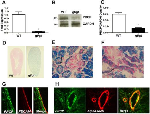 Figure 1. Characterization of the PRCP hypomorph (PRCPgt/gt) mouse. (A) Total renal mRNA was reverse-transcribed to cDNA from C57BL/6 (WT) and PRCPgt/gt (gt/gt) mice, and quantitative PCR was performed. Data represent mean ± SEM of PCR studies from 3 mice in each group. (B) PRCP antigen level was detected by immunoblot with a goat antimouse-PRCP antibody (anti-TND-20) on 100 μg of renal lysate from WT or PRCPgt/gt mice. Anti-GAPDH antibody was used as a loading control. (C) Comparative antigen levels from panel B were quantified with densitometry. The bar graph is the mean ± SEM ratio of PRCP/GAPDH antigen in 4 WT or PRCPgt/gt renal lysates. (D) Longitudinal sections of X-Gal–stained whole mouse kidney from WT and PRCPgt/gt (gt/gt) mice. Kidney sections were stained for LacZ with X-Gal to determine the presence of the CD4TM-β-geo transgene in place of the Prcp gene. Blue LacZ staining in the PRCPgt/gt indicates where endogenous PRCP would be expressed in these tissues from WT mice. The photographs were taken on a Nikon SMZ-U dissecting microscope at 2× magnification. (E) Cross section of X-Gal–stained renal cortex from a PRCPgt/gt mouse showing a Bowman capsule of a glomerulus with LacZ protein and variably darkly stained tubules. The black arrow points to a darkly stained tubule. (F) Longitudinal vessel sections from renal cortex from a PRCPgt/gt mouse showing staining for the LacZ protein, which replaces PRCP.14 The figure is at 40× magnification. Black arrow points to vascular PRCP as indicated by the presence of LacZ. (E-F) Photographed on an Olympus BH-2 microscope aperture 0.70 160/0.17 at 40×. Arterial PRCP was colocalized with the endothelial cell marker PECAM (CD31; G) and the vascular smooth muscle cell marker α-smooth muscle actin (α-SMA; H). (G-H) Photographed on a Zeiss LSM510 confocal microscope aperture 40×/1.3 oil immersion. *P < .05.