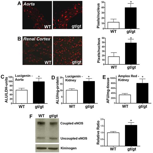 Figure 3. Measurement of tissue ROS in PRCPgt/gt mice. (A-B) Studies on the expression of fluorescence in aorta (A) and kidney (B). Frozen aortas and kidneys from WT and PRCPgt/gt (gt/gt) were stained with DHE. (A-B) Photographed on a Zeiss LSM510 confocal microscope aperture 40×/1.3 oil immersion. The relative DHE fluorescence was measured by morphometric analysis on 40× microscopic images using MetaMorph (Molecular Devices). Data are expressed as the number of fluorescent pixels per nuclei. Data are mean ± SEM of ≥ 9 samples on aorta and ≥ 4 samples on kidney. (C) Superoxide levels (O2.−) were measured from freshly harvested mouse aortas using the chemiluminescent probe lucigenin. Data are mean ± SEM ratio of ALU per LDH units from WT or PRCPgt/gt aortic pieces. (D) Superoxide levels (O2.−) were determined from N-2-hydroxyethylpiperazine-N′-2-ethanesulfonic acid buffer solubilized mouse kidneys using the chemiluminescent probe lucigenin. Data are mean ± SEM ratio of arbitrary lucigenin fluorescent units (ALU) per milligram of renal tissue from WT or PRCPgt/gt. (E) Hydrogen peroxide levels (H2O2) were determined from harvested mouse kidneys using Amplex Red. Data are mean ± SEM ratio of AFU per milligram of dried renal tissue from WT or PRCPgt/gt. (F) An immunoblot for eNOS was performed on renal lysates from WT and PRCPgt/gt. The normalized relative ratio of renal uncoupled/coupled eNOS in lysates from 10 mice from WT and PRCPgt/gt was compared by analysis of band intensity using densitometer scanning. Immunoblot of high molecular weight kininogen was used as a loading control. *P < .05.
