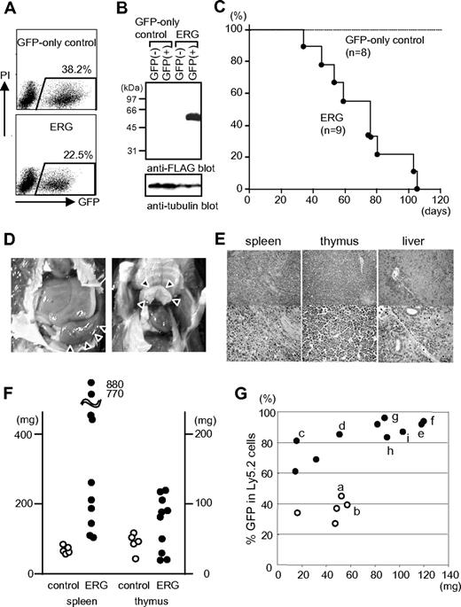 Figure 1. Mouse BM cells transduced with ERG induce leukemia in hosts that received a transplant. (A) FACS analysis of GFP expression in infected BM cells immediately after infection with GFP-only control and ERG-containing viruses. (B) Western blot analysis of lysates from cells sorted immediately after infection with the use of anti-Flag and antitubulin antibodies. (C) Kaplan-Meier survival curve for cohorts of mice that received a transplant with BM cells transduced with the indicated viruses (n = 8 for vector control; n = 9 for ERG). (D) Splenomegaly (left) and enlarged thymus (right) in mice that received a transplant with cells expressing ERG. (E) Leukemic cell infiltration into organs (spleen, thymus, and liver) was determined with the use of H&E staining. Original magnifications: upper panels, ×40 (SPlan4 4×/0.13 160/-objective); lower panels, ×200 (SPlan20 20×/0.46 160/0.17 objective). (F) Weights of spleen and thymus of mice that received a transplant with cells infected with control and ERG-containing viruses. (G) Percentage of GFP among Ly5.2 donor cells repopulated in thymus of Ly5.1 host mice that received a transplant. Open and filled circles represent control and ERG-transduced cells, respectively. Here, “a” to “i” correspond to mice used for the flow cytometric analysis shown in Figure 2A, Southern blot analysis shown in Figure 3C, and mutational analysis shown in Table 1.