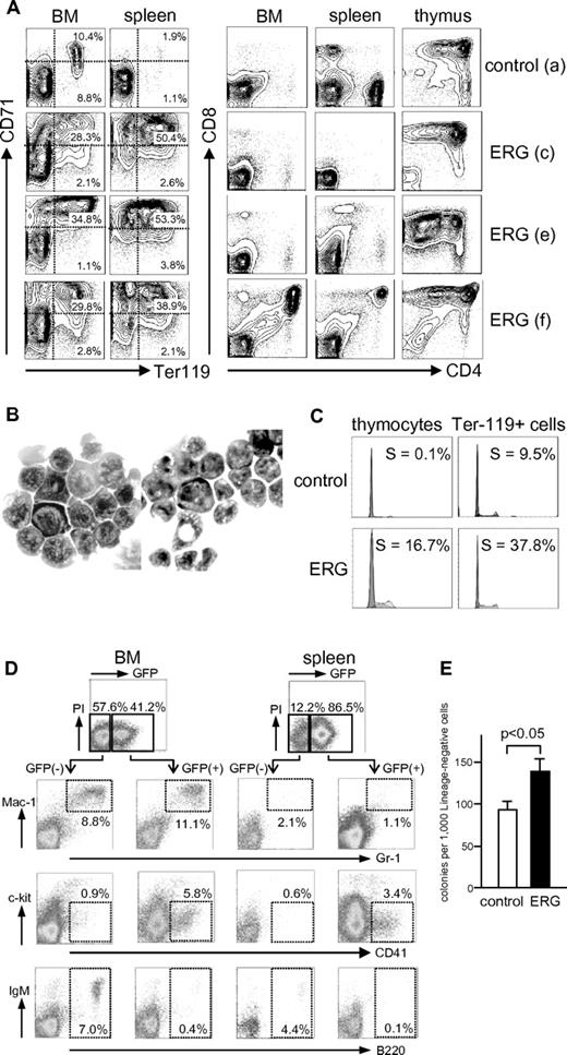 Figure 2. Flow cytometric and morphologic analyses of cells. (A) Typical flow cytometric analyses of cells in BM, spleen, and thymus. Cells were analyzed for expression of the indicated molecules. Typical data are presented for one control mouse that received a transplant with GFP-only–transduced cells and 3 mice that received a transplant with ERG-transduced cells. The “a,“ “c,” “e,” and “f” correspond to mice shown in Figure 1G. (B) Cytospin preparations of spleen cells in an ERG mouse (f) showing clusters of immature erythroid (left) and lymphoid (right) cells. Original magnifications: ×1000 (SPlan100 100×/1.25 oil 160/0.17 objective). (C) Flow cytometric analysis of DNA content of indicated cells in mice that received a transplant with control and ERG-transduced BM cells. Percentage of S phase is presented. Ter-119+ cells were flow-sorted before the analysis. (D-E) Analyses of granulocyte/macrophage, megakaryocytic, and B-cell compartment in ERG mice. Cells obtained from BM and spleen were gated on GFP+ and GFP− fractions for flow cytometric analysis of the indicated molecules. Typical data of 10 mice analyzed are presented (D). Lineage-negative BM cells of control and ERG mice were assayed for colony formation under a granulocyte/macrophage condition, in triplicate. Mean and SD are presented for a typical analysis of 3 independent experiments (E).