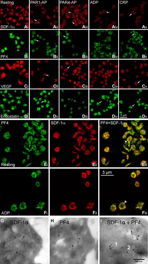 Figure 1. Platelets store proangiogenic and antiangiogenic regulators in separate α-granules. For immunofluorescent staining, PRP (2 × 108 cells/mL) was subjected to the treatment with vehicle (resting), PAR1-activating peptide (PAR1-AP 10μM; SFLLRNPNDKYEPF-OH from Calbiochem), PAR4-AP (100μM; AYPGKF-NH2, from Sigma-Aldrich), ADP (10μM, Sigma-Aldrich), and CRP (1 μg/mL, from Dr R. Farndale, Cambridge, United Kingdom) for 5 minutes at room temperature. Thereafter, PRP was fixed with 2% paraformaldehyde in phosphate-buffered saline (PBS), applied to 0.01% poly-L-lysine-coated coverslips, and then permeabilized with 0.5% Triton X-100. After blocking with 1% bovine serum albumin-PBS, the samples were incubated overnight at 4°C with respective primary antibodies: mouse anti–human SDF-1α/chemokine (C-X-C motif) ligand 12; MAB350 from R&D Systems at 1:20 (Ai-v,E,F); rabbit anti–human PF4/CXCL4 Ab sc-50301 from Santa Cruz Biotechnology at 1:25 (Bi-v,E,F); rabbit anti–human VEGF Ab-1 from Thermo Scientific at 1:500 (Ci-v); and rabbit anti–human endostatin Ab53702 from AbCam at 1:50 (Di-v). After washing, they were incubated with corresponding fluorescent secondary antibodies (DyLight 549 goat antimouse IgG at 1:50, Jackson ImmunoResearch Laboratories; AlexaFluor-488 goat anti–rabbit IgG at 1:100, AlexaFluor-546 goat anti–rabbit IgG at 1:500, and AlexaFluor-488 goat anti–rabbit IgG at 1:100/AlexaFluor-647 donkey anti–mouse IgG at 1:100 for double labeling, all from Invitrogen) for 2 hours at room temperature. After thorough washings with PBS containing 0.3% Triton X-100 and 0.1% Tween-20, the coverslips were mounted with Prolong Gold antifade mounting medium (Invitrogen). Single immunofluorescence (A-D) and SDF-1α/PF4-double immunofluorescence (E-F) platelet images were acquired using a Leica confocal microscope TCS SP2 equipped with an 100× NA1.4 objective. The digital images were assembled into composite images using Adobe PhotoShop Version 10.0.1. The arrows indicate angiogenic factor-staining that was marginized to form a ring-like distribution on platelet activation. The arrowheads indicate the colocalization (yellow) of SDF-1α and PF4. The images are representatives from 4 or 5 experiments. Single immunogold labeling of SDF-1α (MAB350 at 1:20; followed by 5-nm gold protein A probing, arrows; G) and PF4 (sc-50 301 antibody at 1:25, followed by 10-nm gold protein A probing, arrowheads; H) was performed on cryo-ultrathin sections of unstimulated platelets. SDF-1α-PF4 double immunogold labeling (I) was first probed with the SDF-1α antibody, which was indicated by 5-nm gold protein A (arrows) and then probed with the PF4 antibody, which was indicated with 10-nm gold protein A (arrowheads). The samples were visualized with a Leo 906 transmission electron microscope (Leo GmbH) operating with an accelerating voltage of 80 kV and at 60 000× original magnification. Digital images were taken with a Morada camera (SiS Münster). (I) SDF-1α–containing (numbered 1), PF4–containing (2), and SDF-1α-PF4–containing (3) α-granules within 1 platelet. The results shown are representative images from 3 separate experiments.