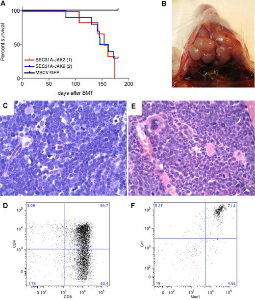 Figure 3. SEC31A-JAK2–derived murine bone marrow transplantation model. (A) Survival curves of 2 independent groups of mice transplanted with SEC31A-JAK2–expressing bone marrow cells show the development of a fatal disease (red and blue curve). Control mice transduced with the empty pMSCV-GFP vector did not show any signs of disease up to 180 days after transplantation. (B) Enlarged lymph nodes of the neck in a mouse presenting with T-lymphoblastic lymphoma. (C) The lymph nodes of mice diagnosed with SEC31A-JAK2–induced T-lymphoblastic lymphoma display effacement of the normal architecture by a monotonous medium-sized blastic proliferation with condensed nuclear chromatin, single nucleolus, and little basophilic cytoplasm (H&E, ×400). Mi indicates mitotic figure. (D) The spleen of mice diagnosed with SEC31A-JAK2–induced T-lymphoblastic lymphoma shows infiltration of mainly CD4−/CD8+ and CD4+/CD8+ cells by FACS analysis. (E) The bone marrow of mice presenting with the SEC31A-JAK2–associated myeloid phenotype displays an increased cellularity of the intertrabecular spaces, caused by a hyperplastic myelopoiesis (H&E, ×400). D indicates doughnut cells; Mk, megakaryocyte; G, granulocytes; and BT, bony trabeculae. (F) The bone marrow of mice presenting with the SEC31A-JAK2–associated myeloid phenotype shows an enrichment of gr1+/mac1+ myeloid cells by FACS analysis. Immunohistochemical images were captured with a Leica DM LB microscope (Leica) using a Leica PL FLUOTAR objective lens (40×/0.70) and a Leica DC200 camera. Images were imported directly into Photoshop CS (Adobe) using the Leica DC200 camera software (Version 2.51).