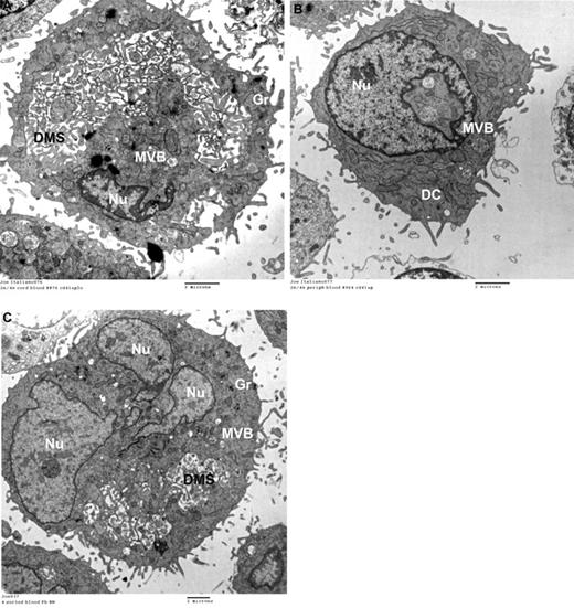 Figure 2. Ultrastructure of MKs by transmission electron microscopy. Human MKs of different ploidy levels were flow sorted after anti-human CD41-FITC and Hoechst 33342 staining and examined by transmission electron microscopy. (A) Representative flow-sorted 2N/4N CB-MKs. The majority of these MKs were mature and exhibited abundant platelet granules and a well-developed DMS. (B) In contrast, 77% of flow-sorted 2N/4N PB-MKs were immature, as evidenced by the absence of a DMS and the paucity of granules (Gr) seen in this representative electron photomicrograph. These immature forms also exhibited multivesicular bodies (MVBs) and dense compartments (DCs), representing the precursors of platelet granules and of the DMS, respectively. (C) Fifty-four percent of all flow-sorted 8N PB-MKs were ultrastructurally similar to the mature neonatal 2N/4N MKs, although they were larger. All images were taken on a G2 Spirit BioTWIN transmission electron microscope (Tecnai) at an accelerating voltage of 80 kV, and recorded with a 2k CCD camera (Advanced Microscopy Techniques).