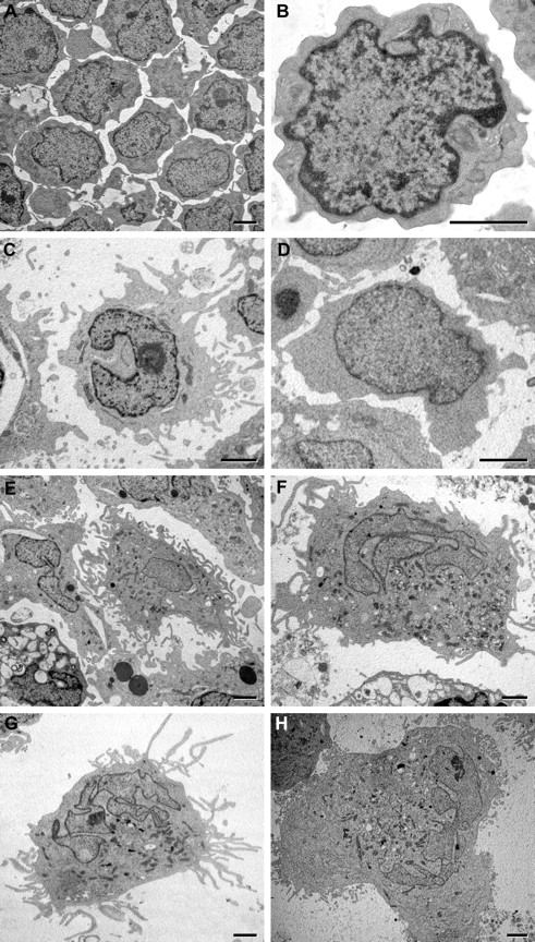 Figure 3. Electron microscopy. CD133+ cells at the start of culture (A-B) and on culture with (C,E,G) and without TGF-β (D,F,H) for 7 days (C-D), 14 days (E-F), and 18 days (G-H). (E) Bottom left corner: cell shows signs of apoptosis. Bars represent 5 μm. Comments on the cell structure at the various time points are detailed in the text. Images were taken with analySIS 5.0 software through a MegaView III camera applied to a JEM 1010 electron microscope at 80kV (Jeol), and were processed for print with Photoshop 6.0 for Macintosh (Adobe).