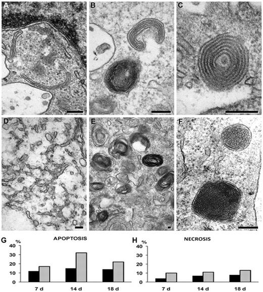 Figure 5. Electron microscopy details. (A-F) Details of cells cultured with TGF-β. (A-C) Variably well-developed multilaminar inclusions (14-day culture). (D) Smooth endoplasmic reticulum (18-day culture). (E) Myelin-like figures (18-day culture). (F) Tubuloreticular inclusions (14-day culture). Bars represent 100 nm. (G-H) Percentage of cells in apoptosis (G) and in necrosis (H) in cultures with TGF-β (black column) and without TGF-β (gray column); only the difference in apoptosis at 14 days was significant (P < .05; χ2 test). Images were taken with analySIS 5.0 software through a MegaView III camera applied to a JEM 1010 electron microscope at 80kV (Jeol), and were processed for print with Photoshop 6.0 for Macintosh (Adobe).