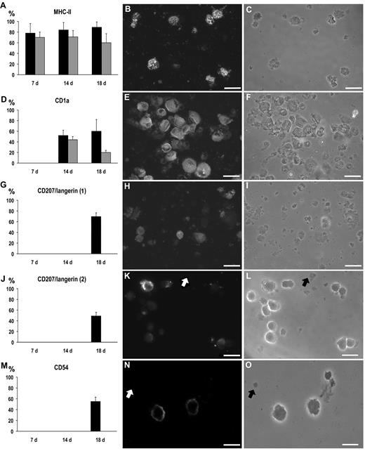 Figure 6. Immunofluorescent labeling. (Left panels) Percentage of labeled cells at immunocytochemistry at 7, 14, and 18 days of culture with (black columns) and without TGF-β (gray columns; mean ± SD). (Middle panels) Immunolabeled cells at fluorescence microscopy, on 18-day culture with TGF-β. (Right panels) Phase-contrast microscopy of the same fields as in the middle panels. (A-C) MHC-II: all the differences between TGF-β treated and untreated cultures were significant (P < .05). (D-F) CD1a; the difference at 18 days was significant (P < .05). (G-I) CD207/langerin (antibody from Novocastra Laboratories). (J-L) CD207/langerin (antibody from Dendritics); note that cellular debris were not stained (arrows). (M-O) CD54; note that cellular debris were not stained (arrows). Bar represents 20 μm. Slides were mounted with Gel/Mount (Biomeda), images were taken with Axio Vision 4.1 software through an AxioCam HRm camera applied to an Axioskop microscope with a 40×0.75 NA air objective (Carl Zeiss), and were processed for print with Photoshop 6.0 for Macintosh (Adobe).