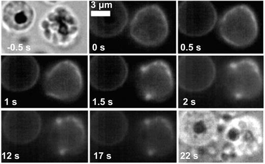 Figure 4. Efficient egress depends on the completed curling and buckling of the RBC membrane. Snapshots of iRBC aborted opening without buckling. The iRBC has been labeled using 1μM PKH26. The different steps of release are presented: pore opening (0.5 seconds), shoulder-type deformation (1 second) before curling. Curling stopped at 2 seconds, leaving merozoites trapped inside the cell (22 seconds).
