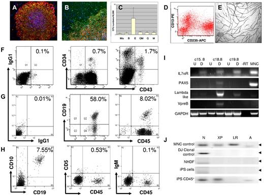 Figure 1. Analysis of iPS phenotype and hematopoietic potential. iPS cells were induced from adult human dermal fibroblasts as described, and ES-like phenotype was confirmed using markers specific to pluripotent stem cells. (A) Staining for TRA-1-81 (green) and SSEA4 (red) (original magnification ×10). (B) iPS colonies are stained for TRA-1-81 (red) and Nanog (green); original magnification, ×20. In all images, nuclear staining is with 4,6-diamidino-2-phenylindole (blue). After a 3-stage differentiation protocol, cell populations were further differentiated toward the hematopoietic lineage using complete methocult H4434; and after 14 days, we see the appearance of CFUs representative of the myeloid lineages. (C) CFU hematopoietic colonies formed from 3 separate iPS cell lines: c15, c18, and c19 (mean ± SEM). These cells were harvested and subsequently stained for CD13 (phycoerythrin) and CD235 (APC) before analysis by FACS (D) where we see distinct populations representing erythroid (CD13−CD235+) and monocytic lineages (CD13+CD235−) similar to that observed in MNC (data not shown). iPS-derived CD34+ cells isolated by MACS after differentiation were expanded in EGM-2 media and assessed for their endothelial function. (E) We demonstrate the ability of these endothelial cells to form tubules when cocultured with human dermal fibroblasts in EGM-2 media for 14 days, which are subsequently stained for CD31 (original magnification, ×10). All images were captured with a Nikon TE300 inverted fluorescent microscope using Hamamatsu Photonics CCD camera and processed with SimplePCI software (Hamamatsu Version 6.6) (Digital Pixel). Demonstration of B-cell lymphopoiesis from human iPS cells. To address whether human iPS cells are able to contribute to the lymphoid compartment, we cultured iPS cells with OP9 stroma for 10 days and cells were stained for CD34 and CD43 and assessed this by FACS. (F) We show (left) isotype and (middle) MNC controls for CD34+ and CD43+ staining with (right) representing populations observed from iPS cells differentiated on OP9. Next, we isolated these CD34+ cells by MACS and cultured on mouse MS-5 stroma for a further 21 days. We then isolated CD45+ cells, again by MACS separation, and stained these for CD45 and CD19. (G) We show (left) isotype control, (middle) staining for UCB-derived CD34+ cells cultured on MS-5 stroma for 21 days, and (right) staining for iPS-derived CD34+ cells also cultured under conditions to promote B-cell lymphopoiesis. (H) We show that a subpopulation of the CD45+ cells from human iPS sources stains double-positive for (left) CD45+ and CD10+ but negative for (middle) CD5 or (right) IgM. This experiment was repeated with 3 cell lines (c15, c18, and c19), thus representing 3 biologic replicates where CD19+CD45+ cells represent 4.67% ± 2.07% (mean ± SEM). B-cell formation was also performed in triplicate with the c18 line, which performed best previously, and here CD19+CD45+ cells represented 7.38% ± 0.86% (mean ± SEM; n = 3). With mRNA isolated from CD45+ cells from 3 separate iPS cell lines (c15, c18, and c19), we show (I) that these differentiated cells (D) are positive for B-cell specific transcripts, such as Pax5, IL7αR, λ-like, and VpreB receptor compared with their undifferentiated (U) counterparts. CD45+ cells from iPS cell line c18.8, which yielded the highest number of B cells by FACS, also had the highest levels B-cell specific transcripts when assessed by reverse-transcribed PCR. (J) We analyzed VDJ rearrangement by PCR amplification of genomic DNA, using primers specific for D-JH recombination. In UCB-derived MNCs (control), we observe clonal rearrangements representative of DN, DXP, DLR, and DA to JH recombinations; also shown is a positive clonal control for DNJ rearrangement (DJ clonal control). Whereas NHDF and iPS cell genomic DNA are shown to be negative for these rearrangements, DNA from CD45+ cells from OP9/MS5-differentiated iPS cells (c18.8 CD45+) are positive for DN, DXP, and DA rearrangements, although not DLR. Amplicons were sequenced and confirmed to map to the IgH locus of the human genome. Full VHJH rearrangement was not observed in any of the iPS-derived CD45+ populations assessed.