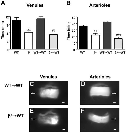 Figure 1. Thrombus formation in sickle cell–transgenic mice. Sickle cell–transgenic mice (βs) and bone marrow chimeras produced from these mice (βs→WT) exhibit accelerated thrombus formation in both cerebral venules (A) and arterioles (B) compared with their WT (WT and WT→WT) counterparts. Images of thrombus formation visualized at 10 minutes demonstrate the significant differences between WT→WT (C-D) and βs→WT (E-F) in both venules (C-E) and arterioles (D-F) of the brain. The arrow indicates the direction of blood flow before cessation. Scale bar indicates 10 μm. Data are shown as the means ± SEM. *P < .05 compared with WT; **P < .01 compared with WT; ##P < .01 compared with WT→WT; ###P < .001 compared with WT→WT. n = 5-6 mice/group.