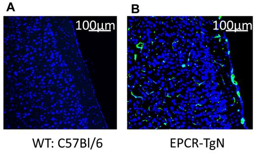 Figure 2. Localization of EPCR in brains from WT and EPCR-transgenic mice. These images show the absence of EPCR in WT mice (A) and the presence of EPCR in both the large vessels and the capillary network of EPCR-TgN mice (B). TO-PRO3 nuclear (N) staining is shown as blue. Scale bars indicate 100 μm.