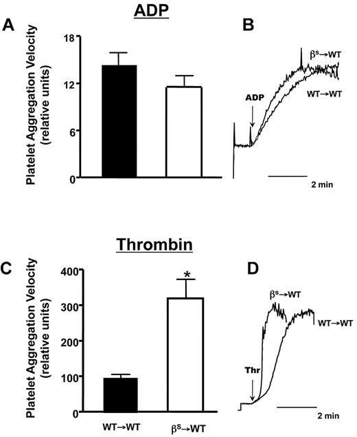 Figure 5. Comparison of ADP- or thrombin-induced aggregation responses of platelets isolated from WT→WT or βs→WT mice. (A,C) Mean aggregation responses to EC50 doses of ADP (733nM) and thrombin (0.63 U/mL). (B,D) Representative aggregation responses to the EC50 doses as detected by a laser-particle analyzer. Data are shown as the means ± SEM. *P < .05 compared with WT→WT. n = 5 mice/group.