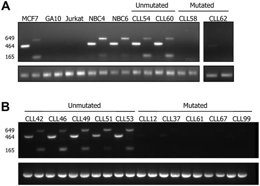 Figure 3. Expression of LDOC1 and LDOC1S mRNAs assessed by RT-PCR. (A) Expression in cell lines, normal peripheral blood B cells, and CLL cells. Wild-type LDOC1 (464 and 649 bp) and LDOC1S (165 bp) mRNAs were detected in the MCF7 breast carcinoma cell line, 2 normal peripheral blood B-cell (NBC) samples, and 2 unmutated CLL samples. Little or no LDOC1 or LDOC1S mRNA were detected in the GA10 Burkitt lymphoma cell line, the Jurkat T-cell lymphoblastic lymphoma cell line, or 2 mutated CLL samples. (B) Expression in CLL cells. Wild-type LDOC1 (464 and 649 bp) and LDOC1S (165 bp) mRNAs were detected in 5 additional unmutated CLL samples. Little or no LDOC1 or LDOC1S mRNA were detected in 5 additional mutated CLL samples. The amount of cDNA amplified for each sample was comparable, as shown by the β-actin signal.