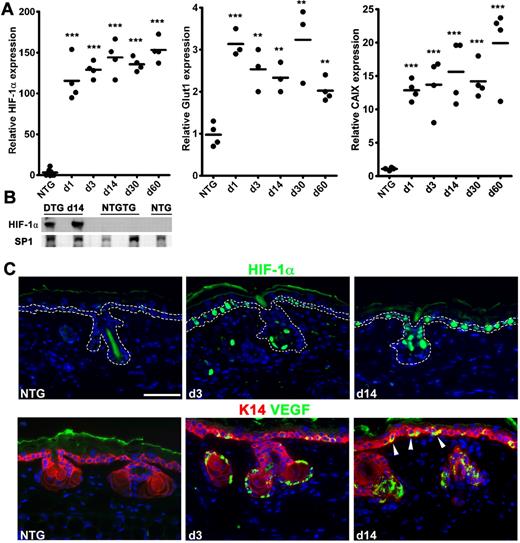 Figure 1. DOX HIF-1αP402A/P564A/N803A transgene induction and target gene up-regulation. (A) Real-time reverse-transcribed polymerase chain reaction analysis of rapid and sustained elevations of transgene and “canonical” HIF-1 target gene mRNAs represented by glucose transporter-1 (Glut1) and CAIX in TetON-HIF-1 transgenic (denoted as “DTG” double transgenic) compared with NTG mice during continuous DOX induction. Prior analysis demonstrated no difference between NTG and DOX day 0 TetON-HIF-1 controls. (B) Transgene protein expression from Western blots of ear nuclear extracts on DOX day 14 in DTG, single TRE-HIF-1αP402/P464A/N803A transgenic mice (NTGTG), or NTG controls. Each dot in scatter plots represents one mouse. Horizontal bars represent the mean. Gene expression measurements for HIF-1α, Glut1, and CAIX were from the same samples. DTG data at each DOX day were compared with NTG or TetON-HIF-1 day 0 data (data not shown), using unpaired Student t test: **P < .01; ***P < .001. (C) Representative HIF-1α transgene and dual VEGF-keratin-14 immunofluorescence, showing expression localization in the interfollicular and hair follicle basal cell compartment after 3 and 14 days of DOX induction. Arrowheads indicate the basolateral VEGF localization within the basal cells. Bar represents 50 μm.