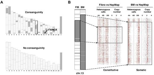 Figure 2. SNP array analysis of paired BM and fibroblast DNAs distinguishes between constitutional homozygosity and acquired UPD. (A) Large chromosomal regions of constitutive homozygosity were detected by SNP array in the DNAs of a male FA patient with a degree of consanguinity (patient EGF067, top panel) but not in a male heterozygote composite FA patient (patient EGF074, bottom panel). Homozygosity regions were detected by comparison with a HapMap reference set; fibroblast and BM DNA analyses are shown on the left and on the right of each chromosome ideogram, respectively. The location of the FANCA gene at 16q24 is shown. Chromosome 13, which harbors both a constitutive homozygosity region in fibroblast (left) and a larger acquired UPD in the BM only (right), is boxed. (B) Enlargement of chromosome 13 data from patient EGF067. Heterozygous (AB) and homozygous (AA and BB) calls and copy number data are indicated. The short constitutive copy-neutral region of homozygosity in fibroblasts (left) and the larger acquired UPD (copy-neutral loss of heterozygosity) in BM (right) are boxed. Analysis was performed from Affymetrix SNP array data with the Partek software.