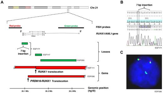 Figure 3. RUNX1/AML1 gene lesions in MDS/AML of several FA patients. (A) Overview of the chromosomal and molecular lesions detected on the RUNX1 gene locus at 21q22 in the BM cells of 6 FA patients with MDS/AML. (Top panel) The genomic position of the RUNX1 exons and of the FISH probes. (Bottom panel) Deletions and gains are represented in green and red, respectively. In patient EGF111, 2 unbalanced translocations involved chromosome 21, the most telomeric interrupting RUNX1 as indicated; a balanced translocation detected in a sixth patient (EGF201) using the RUNX1 flanking probes is not shown. (B) A 7-bp insertion in RUNX1 was found in the EGF171 patient in addition to the large deletion shown in panel A (blast cells 70%). (C) Break-apart and duplication of the 5′ telomeric RUNX1 probe (green) in patient EGF036 with a t(1;21)(p36;q22) (objective lens, original magnification × 63). A fusion PRDM16-RUNX1 was confirmed by combinations of RUNX1 and PRDM16 probes (not shown).
