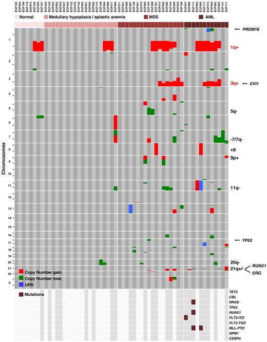 Figure 4. Distribution of the chromosomal and molecular lesions in FA patients. Somatic copy-number gains, losses, and UPD are color-encoded and plotted vertically in chromosomal order for each patient. Samples were clustered horizontally according to the progression stage groups in the BM and then by visual inspection to cluster the abnormalities. The recurrent abnormalities and a selection of relevant genes are indicated on the right part of the figure. 1q+ and 3q+ are specific from FA and are indicated in red, the other abnormalities can be found in non-FA MDS/AML and are indicated in black. Oncogenes and tumor suppressor gene mutation screen data are shown on the lowest panel of the figure; the dark gray background and brown boxes indicate which samples were screen and presence of mutations, respectively.