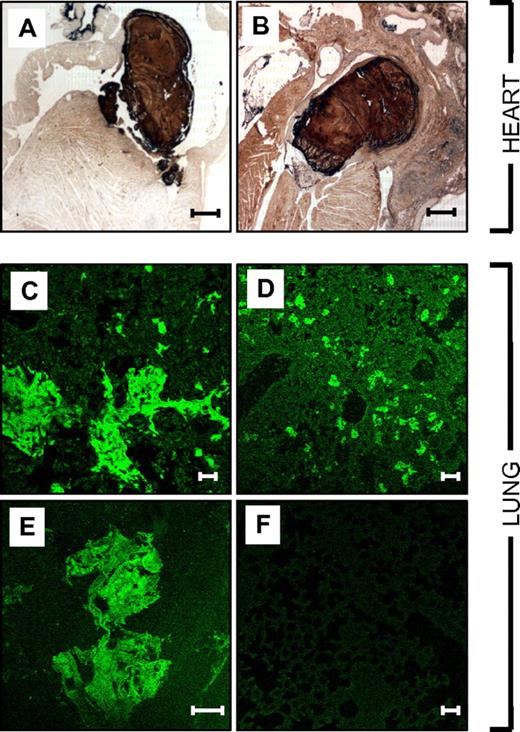 Figure 6. Histologic analysis of hearts and lungs of HA mice overexpressing mFVIIa-VEAY. Fibrin(ogen) immunohistochemical staining in the heart (A-B) showing visible thrombi in the atria. (C-F) Immunofluorescent staining for fibrin(ogen) in the lungs of AAV-mFVIIa-VEAY HA–treated mice (C-E) showing fibrin(ogen) deposition in the lung parenchyma in contrast to untreated HA control mice (F). Scale bars, 500 μm (A-B) and 50 μm (C-F).
