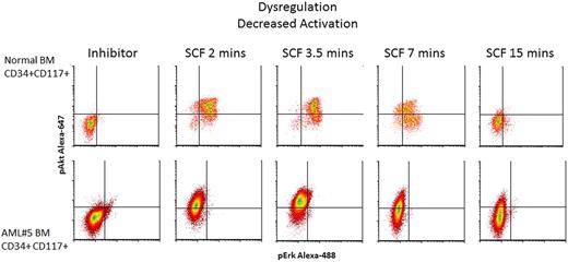 Figure 4. Signal dysregulation in AML. Shown is an example of signaling dysregulation highlighting loss of response to SCF stimulation in the abnormal CD34+CD117+ cell population. The top 5 bivariate density plots show the representative kinetics of up-regulation of pAkt-A647 and pErk-A488 in the CD34+CD117+ cells from a normal BM in response to SCF stimulation. The bottom panel shows SCF stimulation of AML#5 demonstrating typical pAkt-A647 response but lack of pErk-A488 response. Acquired on Gallios flow cytometer and analyzed with FCS Express Version 3.