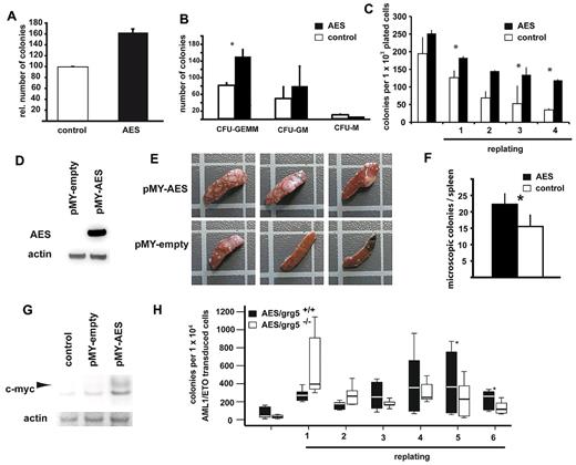 Figure 4. AES enhances proliferation and self-renewal in hematopoietic progenitor cells. Colony formation of murine primary BM cells retrovirally transduced with AES or empty control vector. (A) Higher numbers of relative colonies after AES overexpression. Bars represent relative colony numbers of 3 experiments. (B) The increase in the colony count was associated with an increased fraction of immature colonies (results and SE are shown). *Statistical significance at P < .05. White bars represent empty vector control; and black bars AES overexpression. (C) AES-transduced murine BM cells were serially plated twice. The results of 4 rounds of replating with SE are shown. *Statistical significance at P < .05. White bars represent empty vector control; and black bars AES overexpression. (D) AES-transduced murine BM cells were analyzed for AES expression. (E) CFU-S d12 assays were performed with AES-overexpressing, transduced BM cells and control cells. Three of 5 spleens of mice transplanted with AES-overexpressing cells showed a strong increase in macroscopic CFU-S numbers. These spleens and representative controls are shown. (F) A second set of CFU-S d12 assays with AES-overexpressing, transduced BM cells and control cells was performed, and microscopic colonies were counted. Data are mean plus or minus SD. The difference was statistically significant (P = .001). (G) Protein lysates of spleen tissue with colonies were analyzed for c-myc expression by Western blot analysis. (H) Primary BM cells from GRG5 KO-mice and wt-mice were transduced with AML1/ETO and serially transplated. The results of 6 rounds of replating are shown. *Statistical significance at P < .01 (paired t test).