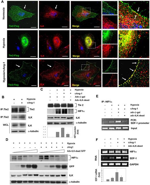 Figure 5. cAng-1 induces Tie2 interaction with ILK on hypoxia, leading to stimulation of HIF-1α/SDF-1 axis. (A) Cells were transfected with pFlag-Tie2 plasmid and immunofluorescence stained with anti-Flag (green) and anti-ILK (red). Nucleus for TOPRO3 (blue). Confocal image showed the interaction of Tie2 and ILK as yellow color which was significantly enhanced at cell membrane by cAng-1. No fluorescence signal in the isotype IgG group. Magnification ×630 with immersion oil; scale bar, 20 μm. (B) Immunoprecipitation (IP) using anti-Tie2 followed by Western blotting for ILK. cAng-1 significantly increased the binding between Tie2 and ILK without change of total amount of ILK. WCL indicates whole cell lysate. (C-F) HUVECs were transfected with adenovirus-β-gal (Adv-β-gal) or kinase-deficient adenovirus ILK (Adv-ILK-dead-GFP) and treated with hypoxia alone or cAng-1 together. Augmentation of hypoxia-induced HIF-1α expression by cAng-1 was obliterated by ILK knockdown. (C) Western blotting and quantification graph of HIF-1α (n = 3). (D) HIF-1α reduction by dose-dependent transfection of Adv-ILK-dead-GFP (n = 2). (E) ChIP analysis shows that augmentation of HIF-1 binding to the SDF-1 promoter by cAng-1 was dependent on ILK (n = 2). (F) SDF-1 mRNA and quantification graph (n = 3). cAng-1–induced SDF-1 mRNA expression decreased in the ILK knockdown group.