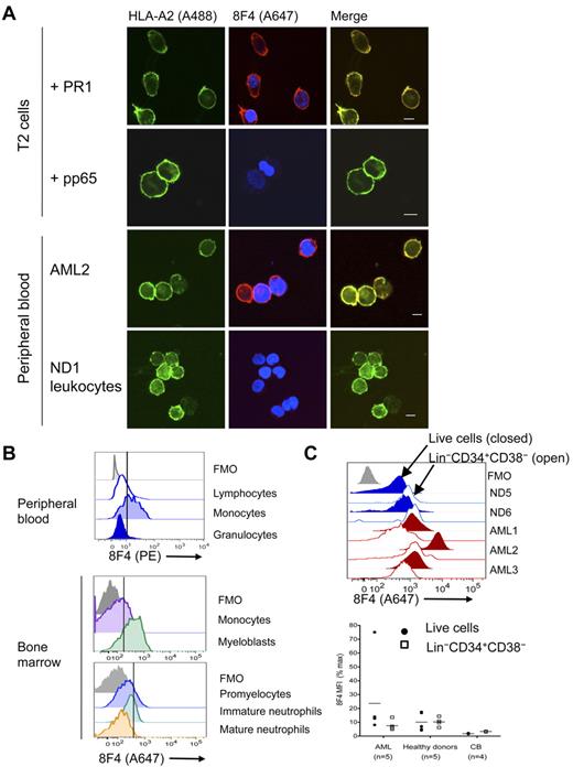 Figure 2. PR1/HLA-A2 visualization on normal and leukemia cells. Visualization was with fluorochrome-conjugated 8F4 in confocal microscopy (A) and flow cytometry (B-C). (A) From top to bottom: T2 cells loaded with PR1, T2 cells loaded with pp65, leukocytes from patient AML2, and leukocytes (PBMCs and granulocytes) from normal donor ND1. Cells were costained with Alexa Fluor 488 (A488)–conjugated anti–HLA-A2 (green; left panels) and Alexa Fluor 647 (A647)–conjugated 8F4 (red) and DAPI (blue; middle panels). Images were viewed with a Leica Microsystems SP2 SE confocal microscope with 10×/25 air, 63×/1.4 oil objectives and Leica Type F immersion oil. Leica LCS software (Version 2.61) was used for image analysis. Scale bar on merged images = 10 μm. (B) PR1 peptide is presented on HLA-A2+ PBMCs from normal donor ND2. Fresh peripheral blood was purified from red cells by lysis, stained with PE-conjugated 8F4 and the phenotype markers CD14, CD3, CD19, CD16, and Live/Dead Aqua viability indicator, and analyzed by flow cytometry (top panel). Scatter profiles and lineage markers identified the indicated cell types. CD14+ monocytes from HLA-A2+ NDs consistently expressed more PR1/HLA-A2 than lymphocytes and granulocytes. Healthy donor ND10 bone marrow cells were labeled with Live/Dead Fixable Aqua, 8F4, HLA-A2, CD34, CD33, CD13, CD14, and a lineage “dump” cocktail composed of Pacific Blue–conjugated CD3, CD7, CD10, CD19, and CD20 (middle panel). Myeloblasts were identified as viable Lin−CD33+CD34+; monocytes were CD14+. Healthy donor ND10 bone marrow cells were labeled with CD45, CD33, CD11b, CD16, and HLA-A2, and 8F4 (bottom panel). Granulocytes were identified based on scatter characteristics and then examined for expression of CD11b and CD16. Promyelocytes were identified as CD11blo/CD16lo; immature granulocytes were CD11bhi/CD16lo; mature granulocytes stained brightly for both markers CD11b and CD16. (C) Histograms show representative labeling of AML samples (red) and fresh bone marrow cells (blue) with 8F4, mAb directed to lineage markers (the Lin cocktail was CD3, CD4, CD7, CD8, CD10, CD14, CD16, CD19, and CD20, all in Pacific Blue or V450 conjugates), CD38, CD34, and Live/Dead Fixable Aqua (Invitrogen; top panel). For each sample, filled histograms show live cells, and open histograms show Lin−CD34+CD38− stem cells. Normal Lin−CD34+CD38− cells show slightly higher 8F4 MFI than total Lin− cells; in contrast, LSCs show lower PR1 expression compared with total blasts. Bottom panel combines 8F4 data from 3 different experiments. Each point represents one patient and is the mean value from 1 to 3 independent experiments. MFI for each sample was normalized and presented as a percentage of the MFI of the positive peak of Simply Cellular compensation beads labeled with 8F4. (B-C) The vertical line through the histograms represents background fluorescence established in the fluorescence-minus-one (FMO; gray) labeling control.