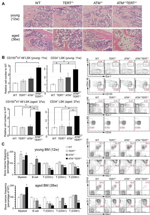 Figure 2. Pathophysiologic aging-related changes in the hematopoietic systems in ATM and TERT doubly null mice. (A) H&E staining of sections of decalcified femur, near the proximal metaphysis, from young mice (12 weeks of age: top) and aged mice (36 weeks of age: bottom). Progression of hypoplastic fatty marrow is apparent in aged TERT−/− mice, and significantly further progression in aged ATM−/−TERT−/− mice, and is absent in young mice. (B) The numbers of CD150+ CD41− CD48− LSKs and CD34− LSKs from ATM−/−TERT−/− mice are increased compared with those of other genotypes. Relative numbers of the indicated fractions of BM cells from young (11 weeks of age: top) and aged (37 weeks of age: bottom) WT (white bar), TERT−/− (light-gray bar), ATM−/− (dark-gray bar), or ATM−/−TERT−/− (black bar) mice (left). Representative FACS analyses of BM-MNCs in aged mice are also shown (right). Total cell numbers of indicated populations are compensated with body weight of each mouse and data shown are frequencies relative to those of WT, with each value representing the mean ± SD of 3 experiments (*P < .05). (C) Myeloid shift is observed in the BM of TERT−/−, ATM−/−, and ATM−/−TERT−/− mice. The shift is most obvious in ATM−/−TERT−/− mice and is also greater in aged mice (38 weeks of age: bottom) than in young mice (12 weeks of age: top). Frequency of each lineage (expressed as a percentage of WT: left) and representative FACS patterns of B-cell lineage and myeloid lineage (right) are shown for the indicated genotypes (*P < .05, **P < .01, n = 3).