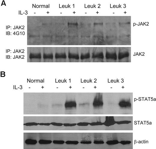 Figure 5. Overactivation of JAK2/STAT5 in FA IL-3Rα–positive blasts in response to IL-3. (A) Human CD45+IL-3Rα+ cells from the bone marrow of FA leukemic recipient mice were isolated by FACS, cultured in the presence or absence of IL-3 (10 ng/mL) for 15 minutes, and whole-cell extracts were prepared. Total proteins (0.5-1 mg) for each indicated sample were subjected to immunoprecipitation with anti-JAK2 antibody. The immune complexes were resolved on 7.5% SDS-PAGE, transferred to nylon membrane, and probed with the anti-phosphotyrosine mAb 4G10 or an anti-JAK2 antibody. (B) Direct Western blot for STAT5a. Whole-cell extracts (∼ 100 μg of total proteins for each indicated sample) from the cells described in panel A were subjected to SDS-PAGE and immunoblotted with antibodies specific for phosphor-STAT5a, total STAT5a, or β-actin.