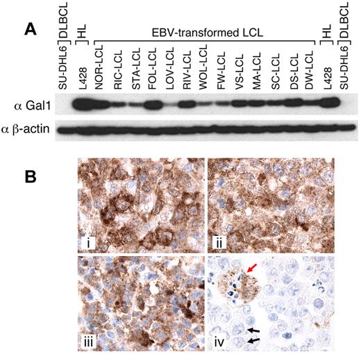 Figure 1. Gal1 expression in EBV-transformed LCLs and primary EBV+ PTLDs. (A) Gal1 expression in a cHL cell line (L428), a series of EBV-transformed LCLs (NOR-, RIC-, STA-, FOL-, LOV-, RIV-, WOL-, FW-, VS-, MA-, SC-, DS-, and DW-LCL), and a DLBCL cell line (SU-DHL6). (B) Gal1 immunohistochemical staining of 3 representative primary EBV+ PTLDs (i-iii) and a DLBCL (iv). In subpanel iv, a Gal1+ macrophage is indicated with a red arrow and representative Gal1− DLBCL tumor cells are indicated with black arrows. The recently developed murine αGal1 mAb 8F4F8G7 was used at 1:20 000 (final concentration, 250 ng/mL) for immunoblots (A) and at 1:40 000 (final concentration, 125 ng/mL) for immunohistochemistry (B). Original magnifications are 1000×.