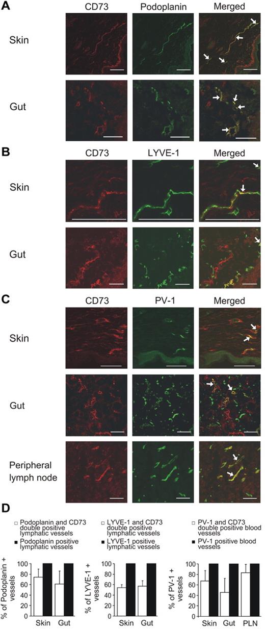 Figure 1. Only a subpopulation of lymphatic and blood vessels express CD73. Double immunofluorescence stainings of human skin and gut with anti-CD73 and anti-podoplanin antibodies (recognizing lymphatic vessels; A), with anti-CD73 and anti–LYVE-1 antibodies (recognizing lymphatic vessels; B) and skin, gut, and lymph nodes with CD73 and anti–PV-1 antibodies (recognizing blood vessels; C). (D) Summary of the results in different organs. Podoplanin-, LYVE-1–, and PV-1–positive vessels have been set as 100% by definition and CD73-positive vessels of those have been presented as mean percentages ± SEM; 35-269 vessels/sample were counted depending on the size of the sample. Arrows point to some double-positive vessels. Scale bar, 100 μm.