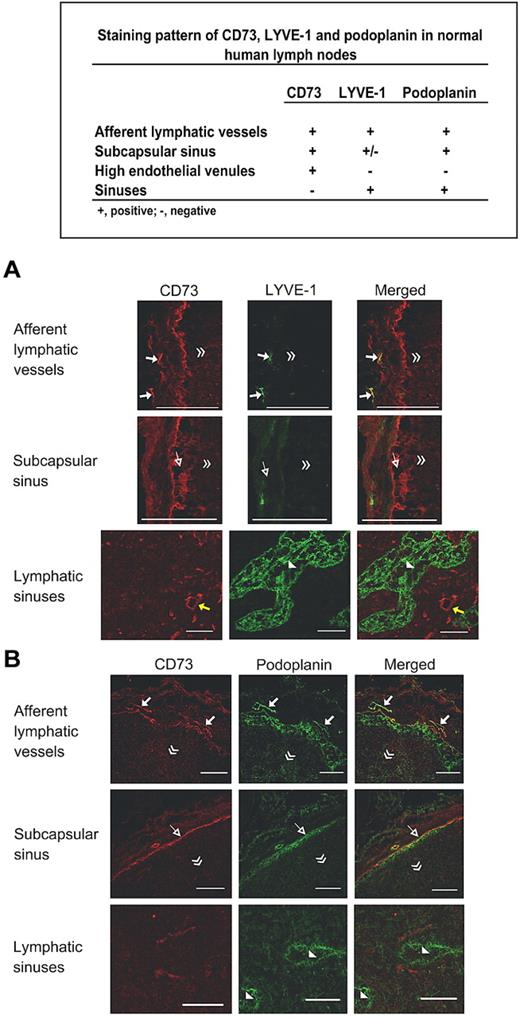 Figure 2. CD73 discriminates afferent and efferent lymphatics. Double stainings of human lymph nodes with anti-CD73 and anti–LYVE-1 antibodies (A) and anti-CD73 and anti-podoplanin antibodies (B). Examples of afferent lymphatics (arrows), endothelium of subcapsular sinuses (open arrows) and HEV (yellow arrows) are pointed out in the appropriate panels. Lymphatic sinuses are indicated with arrowheads. The direction of the lymph node center is indicated with double arrowheads. Scale bars, 100 μm.