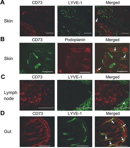 Figure 4. Expression of CD73 in mouse tissues. Double stainings are shown for skin (A-B), lymph node (C), and gut (D) using anti-CD73, anti–LYVE-1, and anti-podoplanin antibodies as indicated. Arrows point to the double-positive vessels and an arrowhead points to the lymphatic sinus. Scale bar, 100 μm.