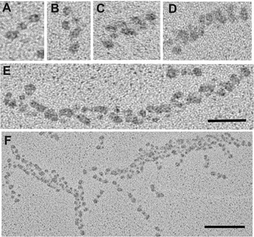Figure 2. Transmission electron micrographs showing representative fibrin structures. Structures can be identified as: (A) monomers, (B) dimers, (C) trimers, (D) tetramers, (E) protofibrils, and (F) fibers. Scale bars, 50 nm (A-E) and 100 nm (F).