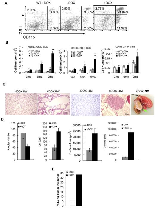 Figure 6. Overexpression of MMP12 caused MDSC expansion, emphysema, and bronchoalveolar adenocarcinoma in the lung of c-fms-rtTA/(TetO)7-CMV-MMP12 the bitransgenic mice. (A) A representative flow cytometric analysis of Gr-1+ and CD11b+ cells from the lung of 3-month doxycycline-treated wild-type (WT) mice, doxycycline-treated (+DOX) bitransgenic mice, and doxycycline-untreated (−DOX) bitransgenic mice. (B) Absolute numbers of Gr-1+CD11b+ cells, Gr-1−CD11b+ cells, and Gr-1+CD11b− cells in the lung of 3-, 6-, and 9-month (3, 6, 9 months) doxycycline-treated (Tg +DOX), untreated (Tg −DOX) bitransgenic mice, and age-matched doxycycline-treated wild-type mice (WT +DOX). Results are the mean ± SD, n > 4. (C) Histologic analysis of doxycycline-treated (+DOX) and untreated (−DOX) bitransgenic mice by H&E staining. After 6 weeks of doxycycline treatment (+DOX 6W), emphysema was observed (original magnification, ×100). Bronchoalveolar adenocarcinomas were found in 4-month (4M) doxycycline-treated lungs, not in age-matched untreated lungs (original magnification, −40). After 9 months (9M) of doxycycline treatment, tumor size became grossly identifiable (pointed by green arrow). (D) Quantitative measurements of alveolar numbers, average mean cord length (Lm), average alveolar surface area, and average alveolar volume for emphysema were determined by MetaMorph imaging software. Results are the mean ± SD, n = 10. (E) The lung adenocarcinoma incidence in 4- to 12-month doxycycline-treated (+DOX) and untreated bitransgenic mice (-DOX). Thirteen of 40 doxycycline-treated mice showed bronchoalveolar adenocarcinoma, and 2 of 40 untreated mice showed tumor; n = 40/group.