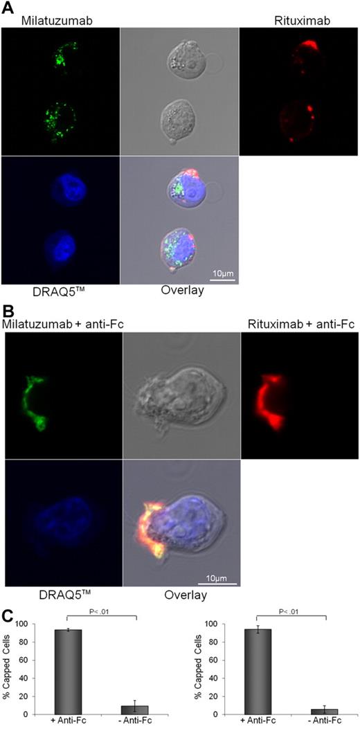 Figure 3. CD20 and CD74 labeling by specific fluorescent antibodies. Binding and internalization of CD20 and CD74 in Jeko cells were examined by laser scanning confocal microscopy. Jeko cells were incubated with rhodamine-conjugated rituximab (red) and Alexa Fluor 488-conjugated milatuzumab (green) in the absence (A) or presence (B) of a cross-linking antibody for 2 hours at 37°C. DRAQ5 was used for nuclear staining (blue). Cross-linked milatuzumab forms large aggregates and colocalizes with cross-linked rituximab on the surface of MCL cells. (C) Representative histograms summarizing the percentage of capped cells in the presence or absence of a cross-linking antibody are shown (Jeko cells left and Mino cells right). At least 100 cell/conditions were counted for each of the 3 independent experiments. Anti–Fc indicates anti–Fc cross-linking antibody.