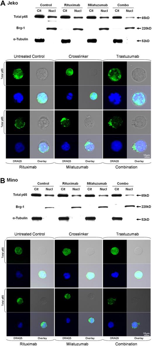 Figure 6. Rituximab and milatuzumab combination treatment inhibited nuclear total p65 translocation in MCL cell lines. Top panels show nuclear and cytosolic protein fractions collected at 4 hours prepared from Jeko (A) and Mino (B) cell lines and subjected to immunoblot analysis for p65, α-tubulin (cytoplasmic control), and Brg-1 (nuclear control). Bottom panels show confocal microscopic analysis of intracellular localization of total p65 (green) in Jeko (A) and Mino (B) cells. MCL cells were treated with cross-linking antibody, trastuzumab, rituximab, milatuzumab, and the combination of rituximab and milatuzumab in the presence of a cross-linking antibody. After 4 hours, cells were collected and prepared for confocal microscopy analysis. DRAQ5 was used for nuclear staining.
