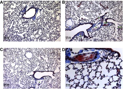 Figure 3. Martius Scarlet Blue staining of lung sections. Mice under baseline conditions (A) compared with thromboembolism-induced mice on MA-T30E5A2 (B,D) or MA-TCK26D6 (C) treatment. Pink represents fibrin stain; yellow-brown, red blood cells; gray, platelets; and blue, connective tissue. *The presence of a platelet-fibrin thrombus. **Platelet-fibrin thrombus of panel B is magnified in panel D.