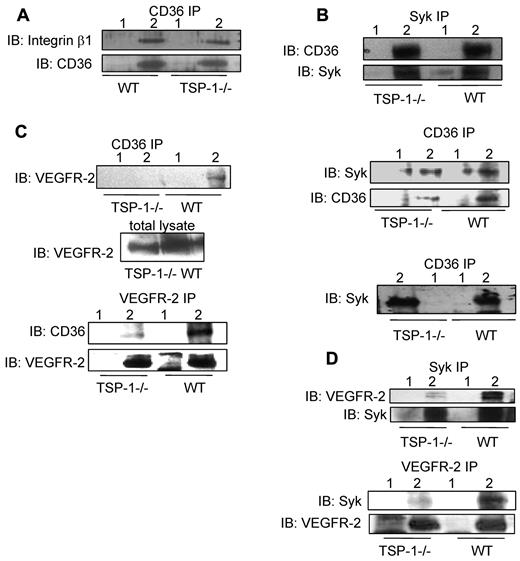 Figure 3. Association of CD36 with VEGFR-2, Syk, and integrin β1 subunit in the lungs of wild-type and TSP-1--null mice. (A) Brij 99 lysates from TSP-1–null and wild-type lung tissues were immunoprecipitated with nonimmune IgG (lane 1) or anti-CD36 Ab (lane 2) and Western blotted with anti-β1 integrin Ab. (B) Top: Triton X-100 lysates from TSP-1–null and wild-type lung tissues were immunoprecipitated with nonimmune IgG (lane 1) or an anti-Syk Ab (lane 2) and Western blotted with an anti-CD36 Ab. Middle: In parallel experiments, tissue extracts were immunoprecipitated with anti-CD36 Ab (lane 2) and nonimmune IgG (lane 1) and Western blotted with anti-Syk and anti-CD36 Abs, as indicated. Bottom: The high-density fractions of sucrose gradients prepared with Triton X-100 extracts of TSP-1-null and wild-type lung tissues (supplemental Figure 6B) were immunoprecipitated with nonimmune IgG (lane 1) or anti-CD36 Ab (lane 2) and Western blotted with an anti-Syk Ab. (C) Top: Brij 99 lysates from TSP-1–null and wild-type lung tissues were immunoprecipitated with nonimmune IgG (lane 1) or anti-CD36 Ab (lane 2) and Western blotted with anti-VEGFR2 Ab. In this experiment, the total lysates were used as loading control (middle panel). Bottom: Brij 99 lysates from TSP-1–null and wild-type lung tissues were immunoprecipitated with nonimmune IgG (lane 1) or anti-VEGFR-2 Ab (lane 2) and Western blotted with anti-CD36 Ab. The immunoprecipitates were also Western blotted with an anti-VEGFR-2 Ab to establish that comparable amounts of VEGFR-2 were immunoprecipitated from the TSP-1–null and wild-type tissue. (D) Top: Brij 99 lysates from TSP-1–null and wild-type lung tissue were immunoprecipitated with nonimmune IgG (lane 1) or anti-Syk Ab (lane 2) and Western blotted with anti-VEGFR-2 or anti-Syk Abs, as indicated. Bottom: Brij 99 lysates from TSP-1–null and wild-type lung tissue were immunoprecipitated with nonimmune IgG (lane 1) or anti-VEGFR-2 Ab (lane 2) and Western blotted with anti-Syk and anti-VEGFR-2 Abs. In these experiments, either total lysates or immunoprecipitants were also Western blotted to establish that comparable amount of proteins were detected or immunoprecipitated from TSP-1–null and wild-type tissues.