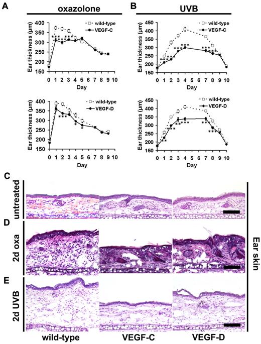 Figure 1. Lymphatic vessel activation reduces edema during acute skin inflammation. (A) K14-VEGF-C (●, n = 7), K14-VEGF-D (●, n = 8) Tg mice, and their wild-type littermates (□, n = 12) were painted with 2% oxazolone and challenged, 5 days later, with 1% oxazolone on the ears. The ear thickness of K14-VEGF-C and K14-VEGF-D Tg mice was significantly reduced compared with wild-type controls at the indicated time points. (B) K14-VEGF-C (●, n = 7), K14-VEGF-D (●, n = 5) Tg mice, and their wild-type littermates (□, n = 11) were irradiated with 200 mJ/cm2 UVB light, and the ear thickness was measured using calipers. The ear thickness of K14-VEGF-C and K14-VEGF-D Tg mice was significantly reduced compared with wild-type controls until day 8 after UVB irradiation. (A-B) Data are mean ± SEM. *P ≤ .05. **P ≤ .01. ***P ≤ .001. (C-E) Hematoxylin and eosin stains of untreated mouse ears (C), at day 2 after oxazolone challenge (2-day oxa, D) or UVB irradiation (2-day UVB, E) revealed reduced edema in inflamed K14-VEGF-C and K14-VEGF-D Tg mice, compared with inflamed skin of wild-type mice. One ear-half is shown. Bars represent 100 μm.