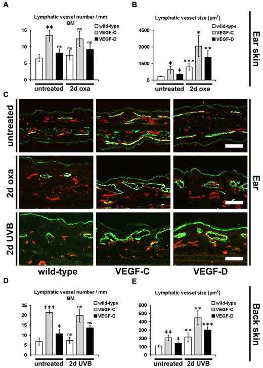 Figure 2. Enlargement of cutaneous lymphatic vessels during acute inflammation. (A-B) Quantitative image analyses of CD31+/LYVE-1+ lymphatic vessels in the ear skin of mice revealed a significantly increased number per millimeter basement membrane (BM, A) and size (B) of lymphatic vessels in untreated K14-VEGF-C Tg mice, compared with untreated wild-type mice (n = 3 mice per group). The lymphatic vessel size was also increased in untreated K14-VEGF-D Tg mice, compared with untreated wild-type mice (n = 3 mice per group). The average number of lymphatic vessels in wild-type mice was not significantly different at 2 days after oxazolone challenge (2-day oxa) compared with untreated wild-type mice. The lymphatic vessel number was also not significantly different between untreated and oxazolone-challenged K14-VEGF-C and K14-VEGF-D Tg mice, respectively (A; wild-type, n = 10; K14-VEGF-C, n = 5; K14-VEGF-D, n = 5). At 2 days after oxazolone challenge, the average size of lymphatic vessels was significantly increased in K14-VEGF-C, K14-VEGF-D Tg, and wild-type mice, compared with untreated mice of the same genotype (B). (C) Representative images of CD31+/LYVE-1+ lymphatic vessels (green) in the ear skin. CD31+/LYVE-1− structures represent blood vessels (red). The positive staining of LYVE-1 in the stratum corneum in panel C is unspecific. Bars represent 100 μm. (D-E) The average lymphatic vessel number (D) and size (E) were significantly increased in the back skin of untreated K14-VEGF-C and K14-VEGF-D Tg mice, compared with untreated wild-type mice. At 2 days after UVB irradiation (2-day UVB), lymphatic vessel size (E), but not lymphatic vessel number (D), was significantly increased in K14-VEGF-C, K14-VEGF-D, and wild-type mice compared with untreated mice of the same genotype. (A-B,D-E) Data are mean ± SD. ‡P ≤ .05. ‡‡P ≤ .01. ‡‡‡P ≤ .001. ns indicates not significant versus untreated wild-type. *P ≤ .05. **P ≤ .01. ***P ≤ .001. ns indicates not significant versus untreated mice (untreated wild-type vs 2-day oxa/2-day UVB wild-type; untreated VEGF-C vs 2-day oxa/2-day UVB VEGF-C; untreated VEGF-D vs 2-day oxa/2-day UVB VEGF-D).