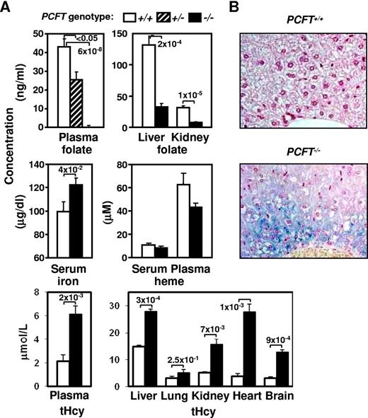 Figure 5. Absence of PCFT decreases systemic folate content and leads to iron and homocysteine buildup. (A) Concentration of folate, iron, heme, and tHcy in the indicated tissues was determined in 4- to 6-week-old mice of indicated genotype. Data are presented as in Figure 2; n = 12 mice in each cohort. (B) Gomori iron staining of liver sections (original magnification 40×/0.75 NA dry objective). Iron is detected in periportal hepatocytes of PCFT−/− mice mainly as fine cytoplasmic stippling and rarely as cytoplasmic granules on a diffuse light blue cytoplasmic background. Iron is not detected by Gomori staining in liver sections from WT animals.