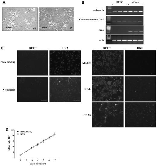 Figure 2. Characteristics of REPCs. (A) Morphology of REPCs at days 1 and 7 in culture. Shown are representative microscopic images at a final magnification of 400×. (B) Expression of kidney fibroblast–specific markers on REPCs compared with human kidney tissue. The EMT marker FSP-1 was not expressed in REPCs. Shown are representative agarose gels stained with ethidium bromide. (C) Differential expression of epithelial and neuronal markers on REPC and HK2 cells. REPCs were negative for the epithelial marker N-cadherin and lectin staining, but positive for MAP-2, NF-L, and CD73. (D) Proliferation of REPCs under normoxic and hypoxic conditions. REPCs were cultured for up to 7 days under normoxic and hypoxic conditions. Cells were counted every day, and cell proliferation was not influenced by hypoxia. Shown are the means ± SD; n = 6.