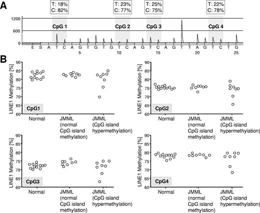 Figure 4. Quantitative LINE1 bisulfite pyrosequencing. (A) Example of LINE1 pyrogram. The percentage of C and T (corresponding to methylated and unmethylated cytosine, respectively) are shown in boxes above each CpG site (gray shading). Overall LINE1 methylation is estimated from the average proportion of C across 4 CpG sites. (B) LINE1 methylation at 4 CpG sites in hematopoietic cells from 12 healthy controls and 21 JMML cases. The JMML cases are grouped into 8 cases with normal CpG island methylation (patients A054, CH017, D097, D116, D257, D454, D675, and SC102) and 8 cases with hypermethylation in at least 3 of 4 CpG islands (patients D020, D127, D360, D361, D397, D567, D684, and PL019).