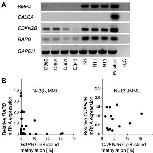 Figure 5. Relationship between gene silencing and CpG island hypermethylation in JMML. (A) Results of RT-PCR to detect the mRNA expression of BMP4, CALCA, CDKN2B, and RARB in peripheral blood cells from 4 JMML patients (patients D360, D359, D651, and D341) and from 3 healthy controls (patients N1, N11, and N13). (B) mRNA expression levels of the RARB gene (left; N = 33) and the CDKN2B gene (right; N = 13) in JMML PB MNCs in relation to CpG island methylation. Expression levels were measured by quantitative RT-PCR and CpG methylation was measured by MassARRAY. The average RARB mRNA expression in blood cells from 5 healthy controls was used as calibrator and was set to 1.0.