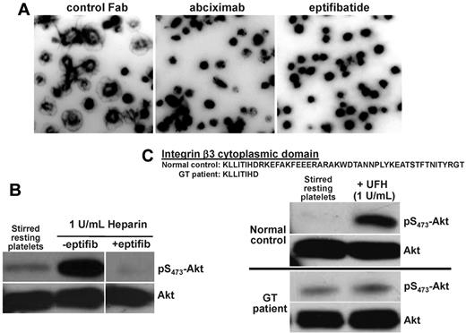 Figure 4. αIIbβ3 is required for heparin-induced potentiation of human platelets. (A) Fibrinogen receptor antagonists inhibit platelet spreading on immobilized heparin. Washed human platelets were added to heparin-coated glass slides in the presence of either a control IgG Fab fragment (left panel) or glycoprotein IIb-IIIa receptor antagonists, 10 μg/mL abciximab (middle panel) or 6.67 μg/mL eptifibatide (left panel). Note that platelet spreading 45 minutes later was abolished by either fiban. (B) Eptifibatide blocks heparin-induced platelet potentiation in solution. Washed platelets were stirred at 1000 rpm at 37°C alone or in the presence of heparin with or without 6.67 μg/mL eptifibatide, lysed, and subjected to immunoblot analysis as described in the legend to Figure 1. (C) Functional αIIbβ3 complexes are required for heparin-induced platelet potentiation. Platelets from a normal person or from a patient with variant Glanzmann thrombasthenia whose platelets express 100% levels of αIIbβ3 lacking most of the C-terminus of the β3 cytoplasmic domain were stirred in the presence or absence of UFH. Note that the increase in Akt phosphorylation normally induced by heparin exposure does not take place in platelets expressing signaling-defective αIIbβ3.