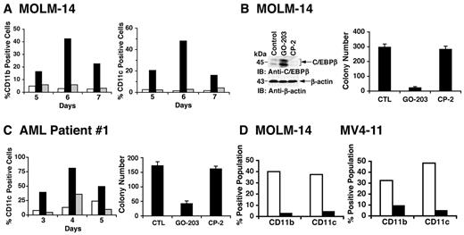 Figure 6. AML cells respond to GO-203 with induction of ROS-mediated myeloid differentiation. (A) MOLM-14 cells were left untreated (□), and treated with 2.5μM GO-203 (■) or 2.5μM CP-2 (▩) each day for the indicated days. Cells were analyzed for the percentage with expression of CD11b (left) and CD11c (right). (B) MOLM-14 cells were left untreated, and treated with 2.5μM GO-203 or 2.5μM CP-2 each day for 6 days. Lysates were immunoblotted with the indicated antibodies (left). Cells were seeded in agar in the absence of drug and colonies were counted at 14 days. The results are expressed as the number of colonies (mean ± SD of 3 determinations) (right). (C) AML patient 1 cells were left untreated (□), and treated with 2.5μM GO-203 (■) or 2.5μM CP-2 (▩) each day for the indicated days. Cells were analyzed for the percentage with expression of CD11c (left). On day 6, the cells were seeded in agar in the absence of drug and colonies were counted at 14 days. The results are expressed as the number of colonies (mean ± SD of 3 determinations) (right). (D) MOLM-14 (left) and MV4-11 (right) cells were treated with 2.5μM GO-203 in the absence (□) and presence (■) of 5mM NAC for 6 days. The cells were then analyzed for the percentage with expression of CD11b and CD11c.