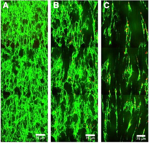 Figure 2. Visualization of patent channels formed in clots by RBC-PAs under flow. Z-projections of 3 successive low-magnification images are stitched together with the direction of flow from bottom to top. (A) Just after the start of 160 s−1 shear (16 minutes), fibers and incorporated RBC-PAs are visible (both green), along with a few pores. (B) At 24 minutes, channels have begun to form from pores enlarging in the direction of flow. Some buffer-derived bystander RBCs (red) have entered clots and become trapped in the network. Fibers that have partially lysed tend to align in the direction of flow. (C) At 37 minutes, clearly visible patent channels have formed, and the strands of network that remain are aligned. Some RBC-PAs and buffer-derived RBCs are trapped in the remaining fibrin; the majority of the bystander RBCs traverse clots via channels, and many flow through the sample moving too fast to be captured in these Z-projections but can be detected in the videos (supplemental Data).
