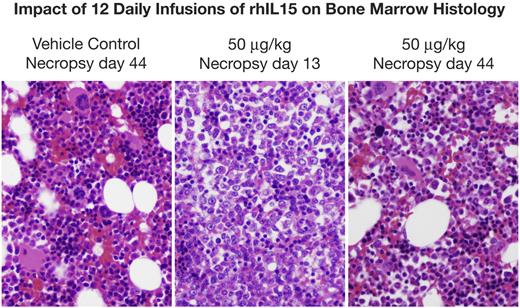 Figure 3. rhIL-15 administration is associated with hypercellular marrow and a reduction in adipocytes. Shown is the impact of rhIL-15 on the bone marrow examination of animals receiving vehicle diluent control or rhIL-15 at 50 μg/kg/d for 12 days. Left panel is the vehicle control bone marrow at day 44. Center panel is the bone marrow of animals receiving 50 μg/kg/d for 12 days determined at necropsy at day 13 within 24 hours of the last rhIL-15 administration showing marrow hyperplasia with a reduction in adipocytes. Right panel is the bone marrow examination of rhesus macaques receiving 50 μg/kg/d for 12 days studied at necropsy at day 44, 32 days after the last rhIL-15 administration, showing a return to a normal marrow pattern.